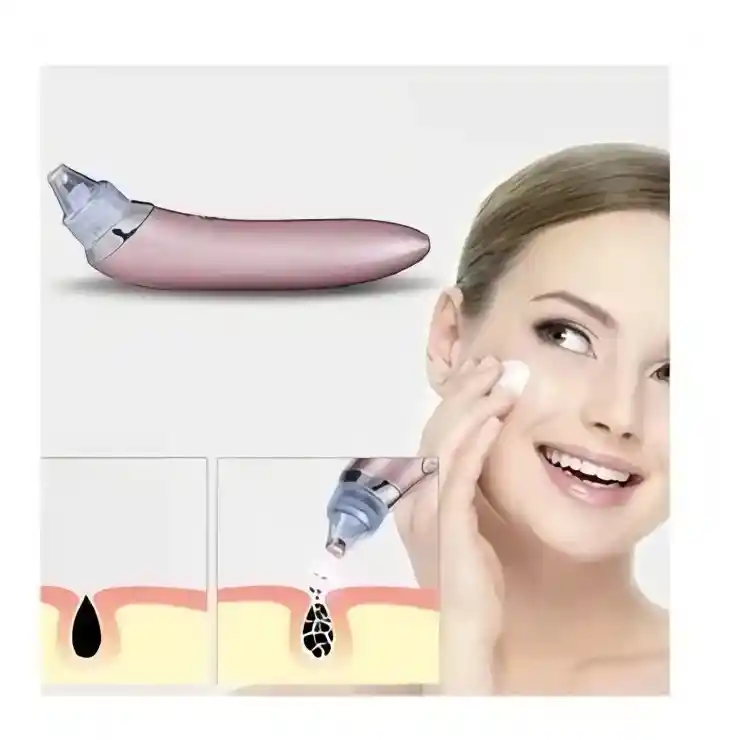 Limpiador Facial Puntos Negros, Poros, Barros Toda