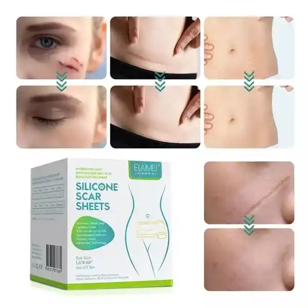 Cinta De Silicona Para Quitar Cicatrices Parche Color Nude