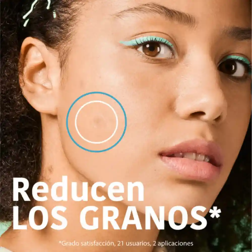 Iroha Parches Con Ácido Salicílico X 18 Parches