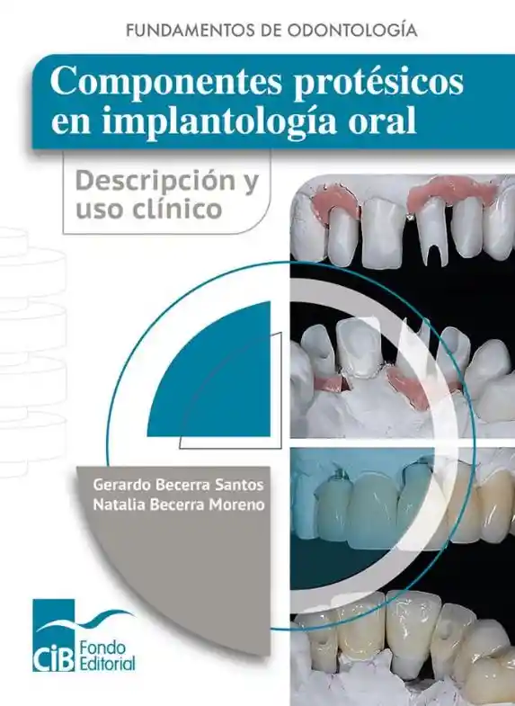 Componentes Protésicos en Implantología Oral