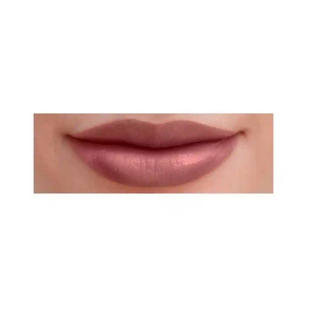 Labial