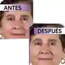 Serum Facial Para Las Arrugas - Lishé