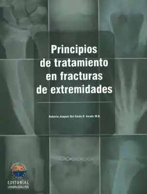 AdeS Principios De Tratamiento En Fracturas De Extremid