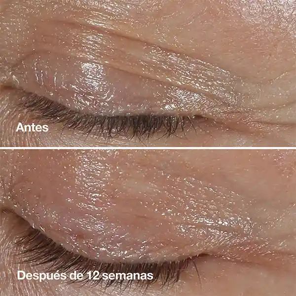 Clinique Crema Contorno de Ojos Smart Clinical Repair Wrinkle