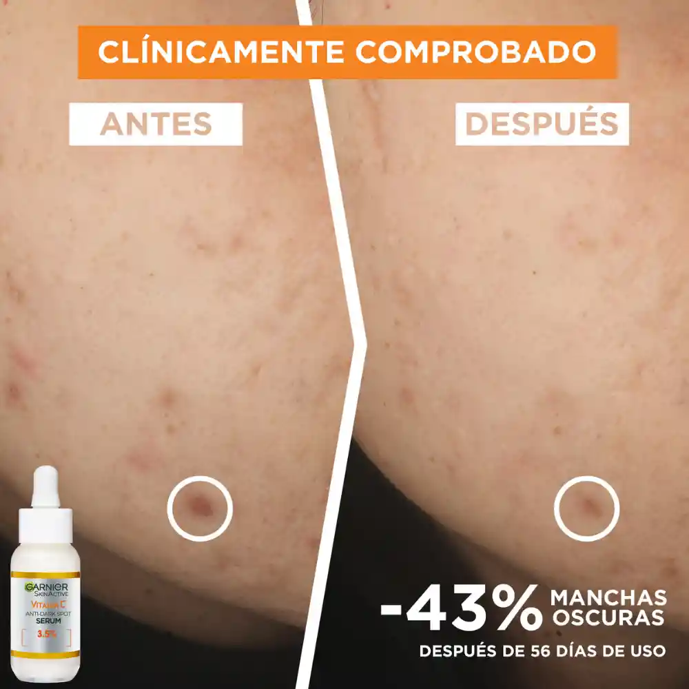 Serum Garnier Vitamina C Express Aclara 30 ml