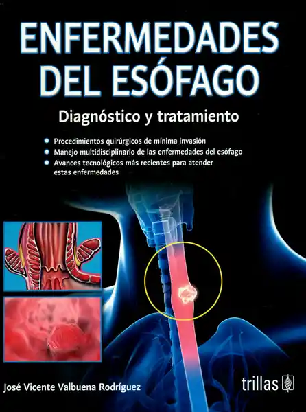 AdeS Enfermed Del Esofago - Jose Vicente Valbuena Rodriguez
