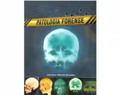Patología Forense