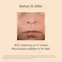 Melaclear Advance Serum Refill - Isdin