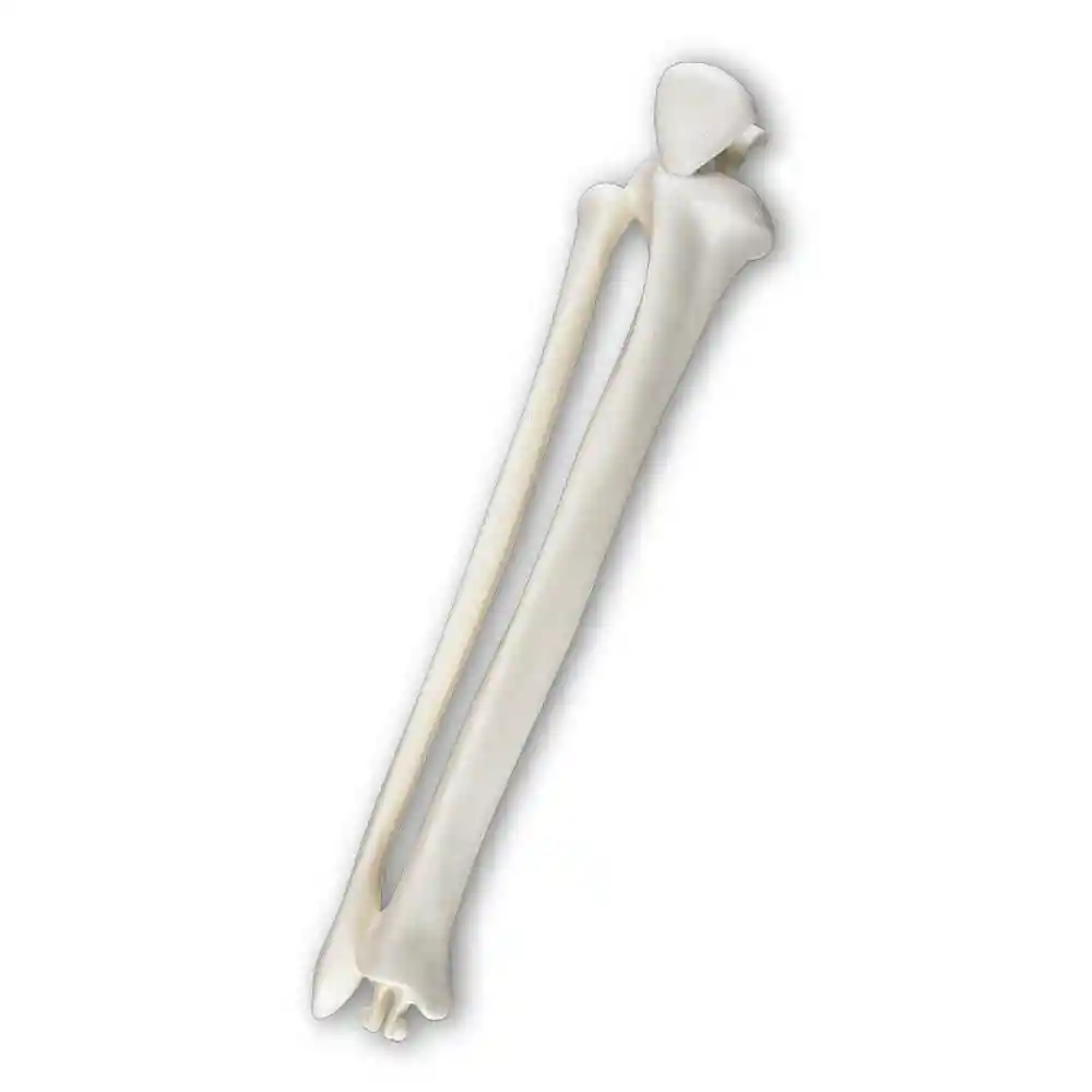 Tíbiaperoné Derechos Rba