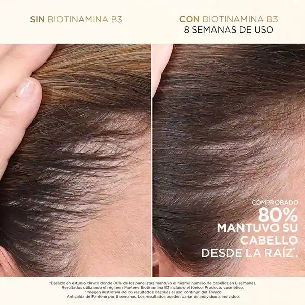 Shampoo Anticaída+ Pantene Biotinamina B3 510 mL