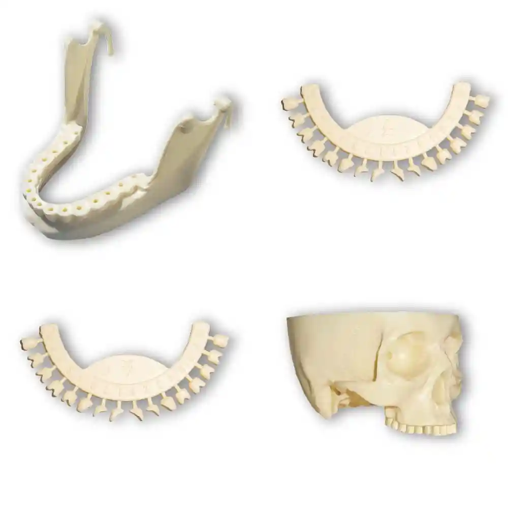 Cuerpoh T1 Craneo Externo Rba