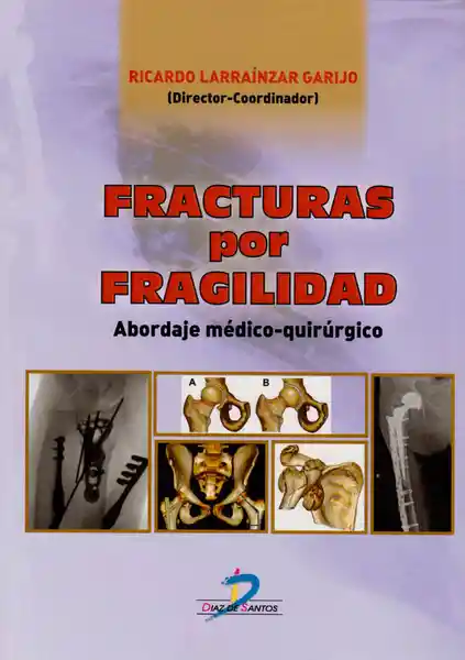 Fracturas Por Fragilidad Abordaje Médico - VV.AA