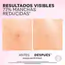 Serum Antimanchas Ácido Glicólico LOréal Paris 30 mL