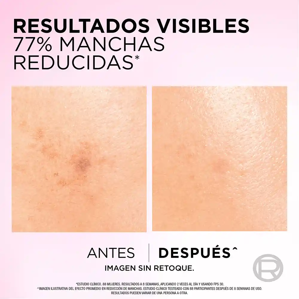 Serum Antimanchas Ácido Glicólico LOréal Paris 30 mL