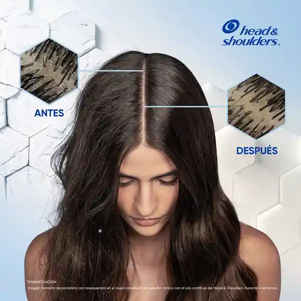 Head & Shoulders Shampoo Anti-Resequedad Nutrición Diaria 1 L