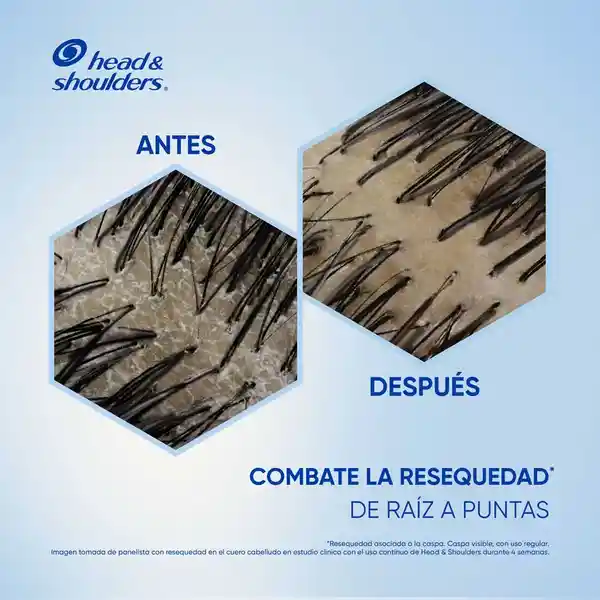 Head & Shoulders Shampoo Anti-Resequedad Nutrición Diaria 1 L