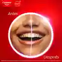 Pluma Blanqueadora Colgate Luminous White Wand