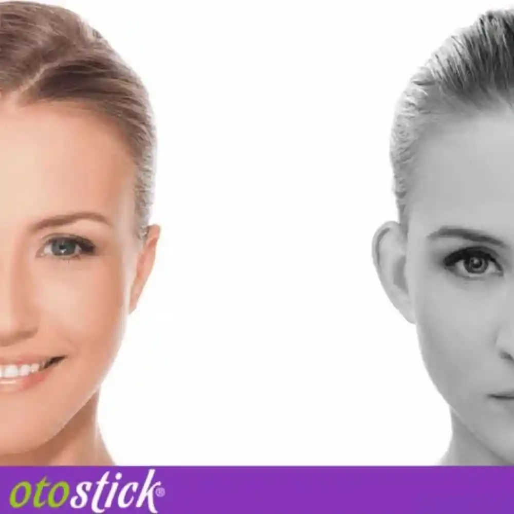 Otostick Correctores Estéticos de Orejas