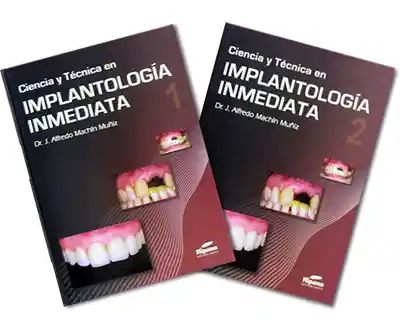 Ciencia y Técnica en Implantología Inmediata 2 Tomos